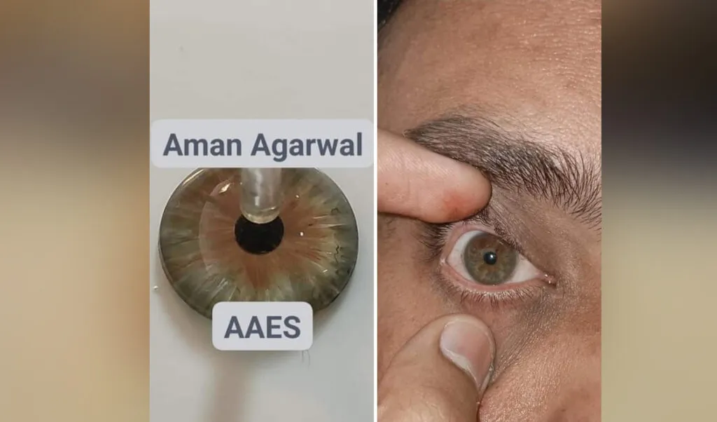 Why choose Advanced Artificial Eye Services