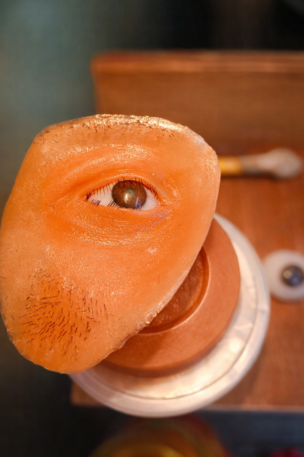 Silicone Orbital Prosthesis