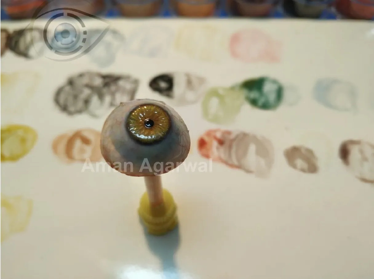 Digital Ocular Prosthesis